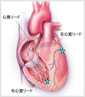 心臓の図